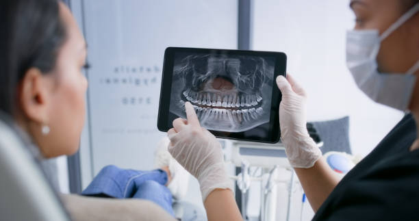 Licensed Tooth Extraction service in Draper, UT - Smile Center Dentistry